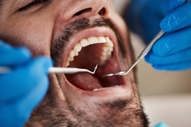 Best Emergency Dental Care for Sports Injuries in West Milton, PA